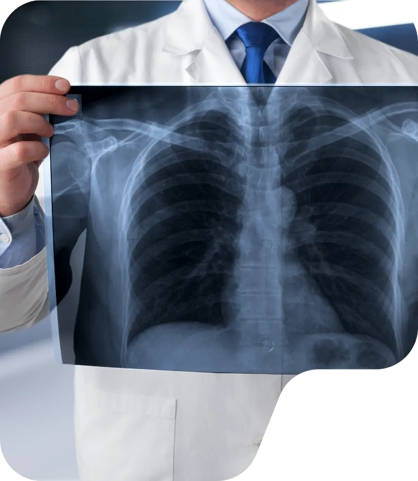 Thoracic Imaging