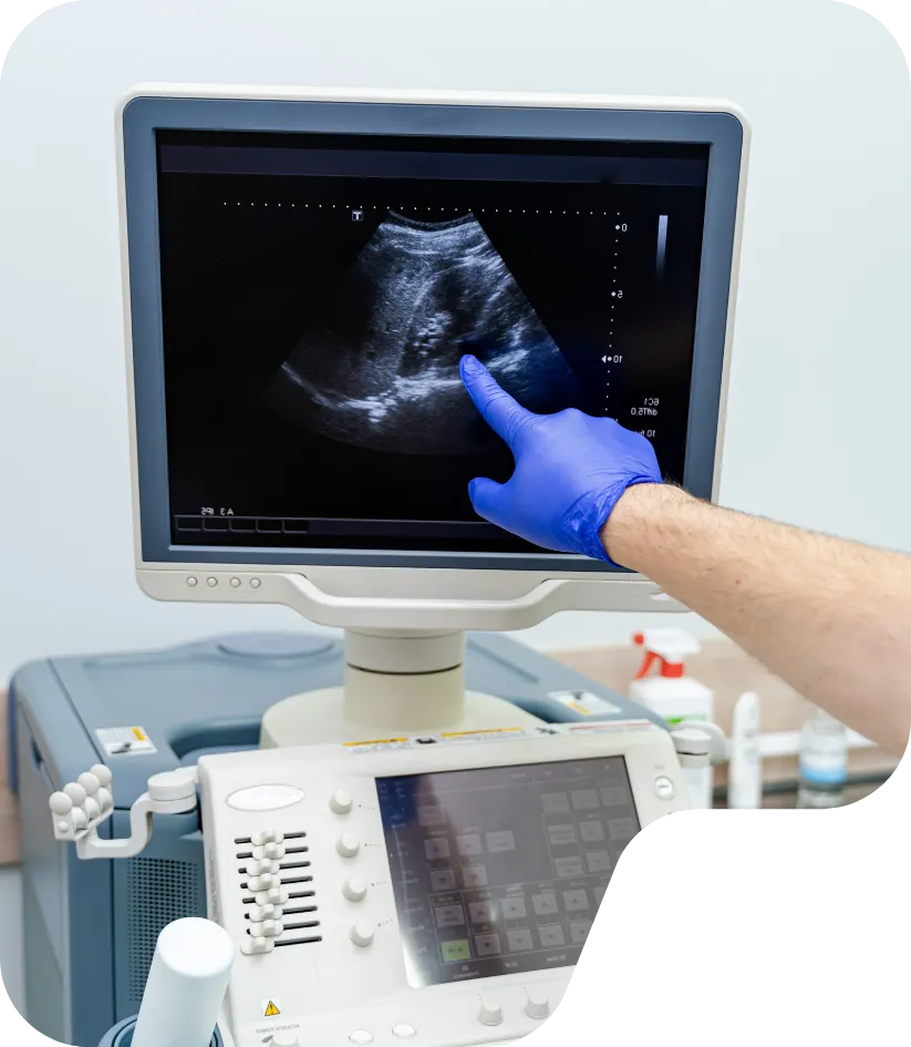 Ultrasound Imaging